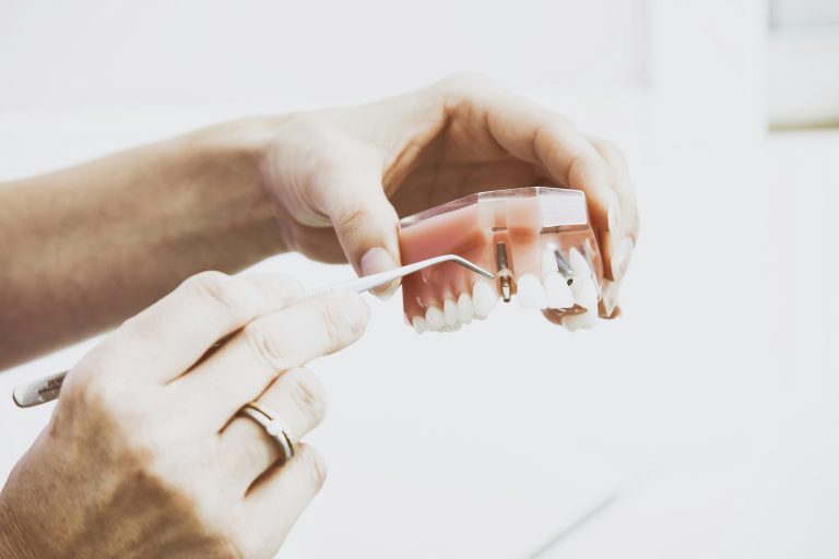 Zubni implantaty