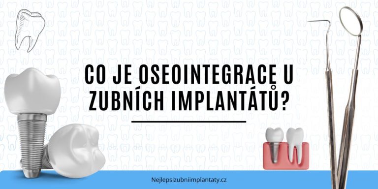 Co je oseointegrace u zubních implantátů