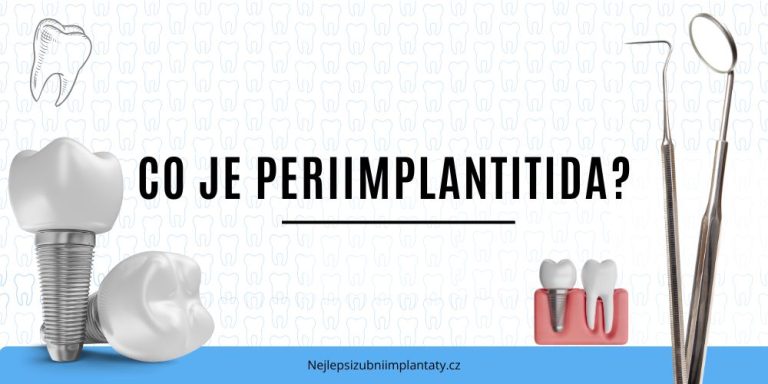 Co je periimplantitida