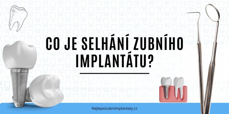 Co je selhání zubního implantátu
