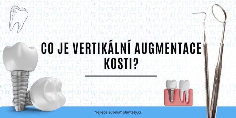 Co je vertikální augmentace kosti