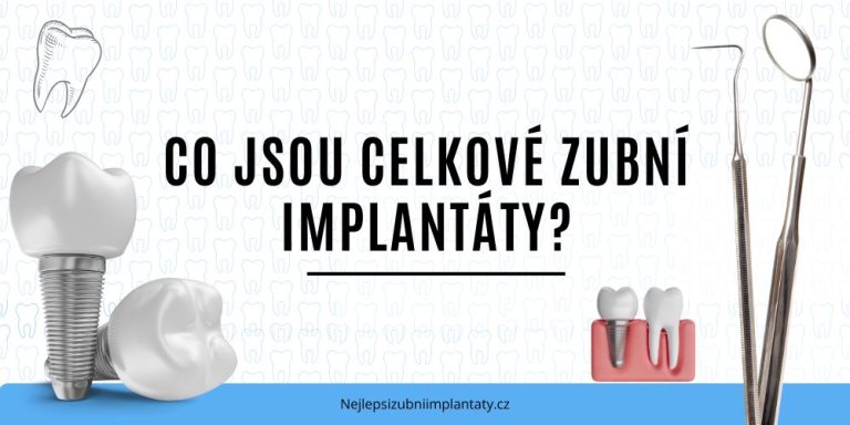 Co jsou celkové zubní implantáty