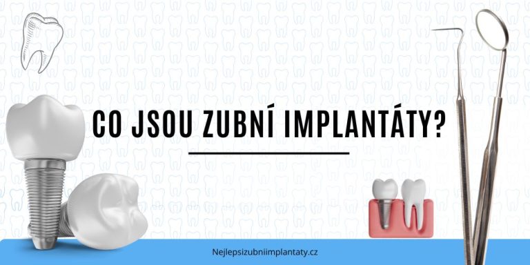 Co jsou zubní implantáty