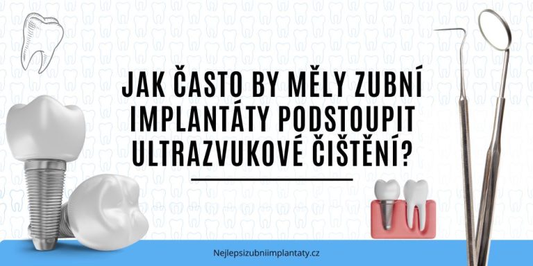 Jak často by měly zubní implantáty podstoupit ultrazvukové čištění