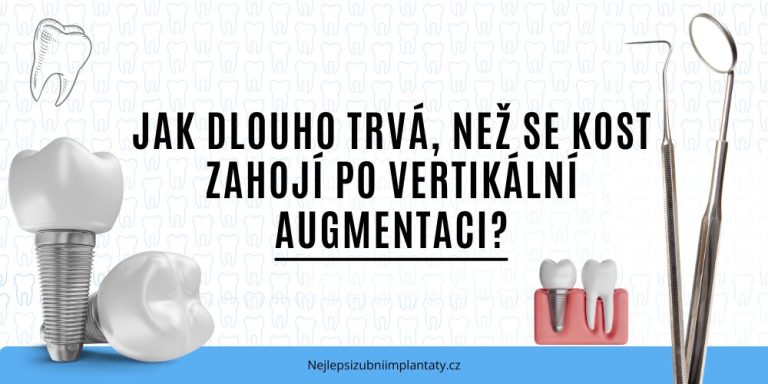 Jak dlouho trvá, než se kost zahojí po vertikální augmentaci