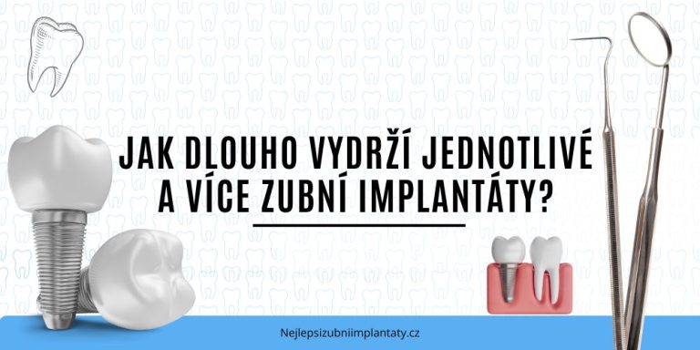 Jak dlouho vydrží jednotlivé a více zubní implantáty