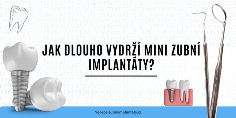 Jak dlouho vydrží mini zubní implantáty