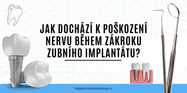 Jak dochází k poškození nervu během zákroku zubního implantátu