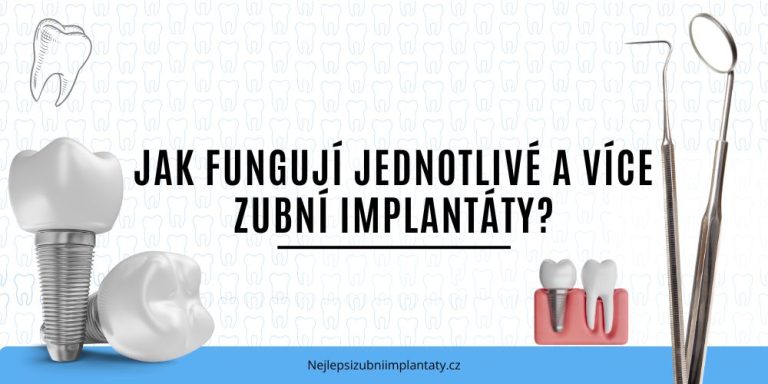 Jak fungují jednotlivé a více zubní implantáty