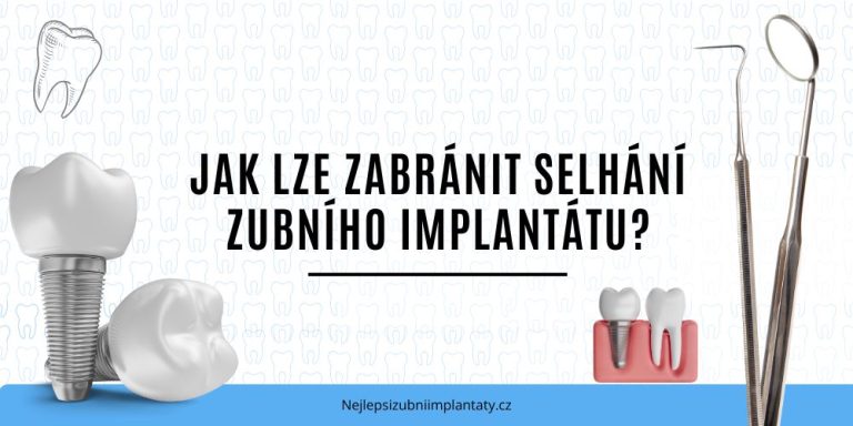 Jak lze zabránit selhání zubního implantátu
