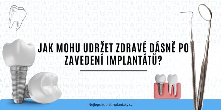 Jak mohu udržet zdravé dásně po zavedení implantátů