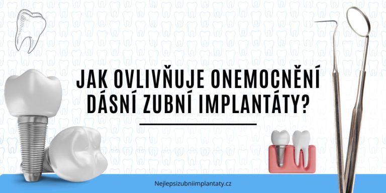 Jak ovlivňuje onemocnění dásní zubní implantáty