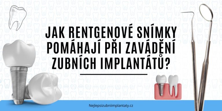 Jak rentgenové snímky pomáhají při zavádění zubních implantátů