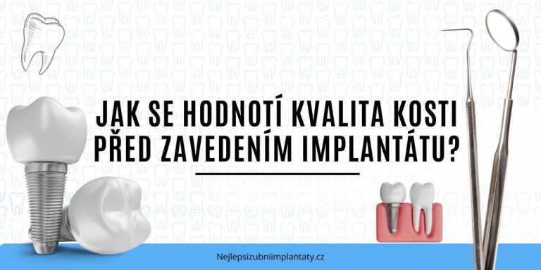 Jak se hodnotí kvalita kosti před zavedením implantátu