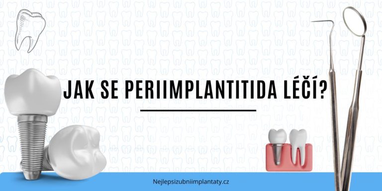 Jak se periimplantitida léčí