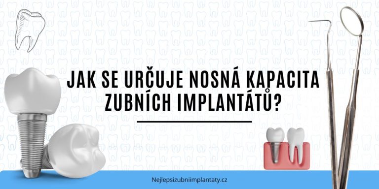 Jak se určuje nosná kapacita zubních implantátů
