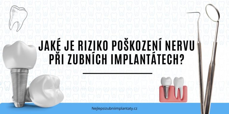 Jaké je riziko poškození nervu při zubních implantátech