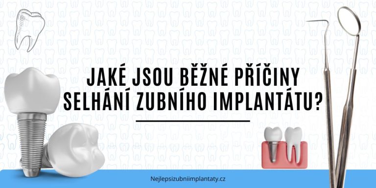 Jaké jsou běžné příčiny selhání zubního implantátu