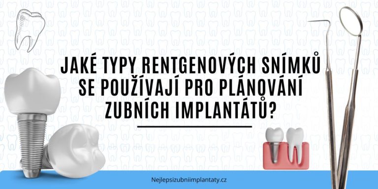 Jaké typy rentgenových snímků se používají pro plánování zubních implantátů