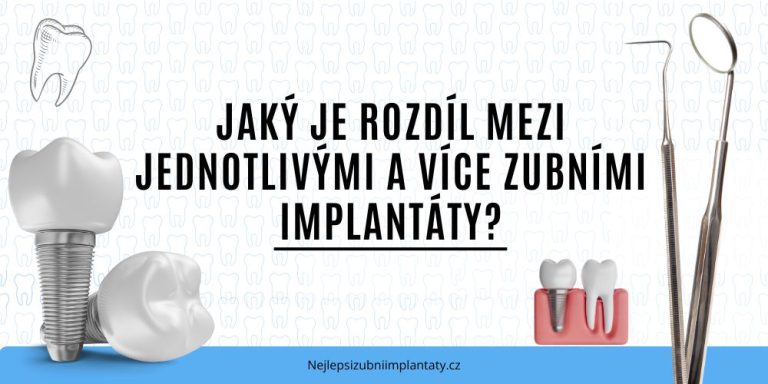 Jaký je rozdíl mezi jednotlivými a více zubními implantáty