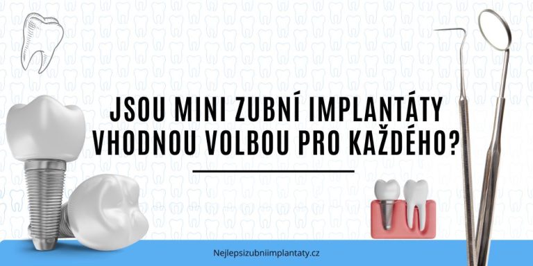 Jsou mini zubní implantáty vhodnou volbou pro každého