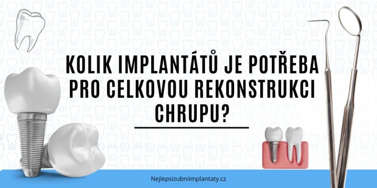 Kolik implantátů je potřeba pro celkovou rekonstrukci chrupu