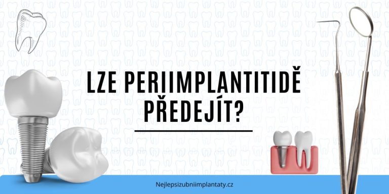 Lze periimplantitidě předejít