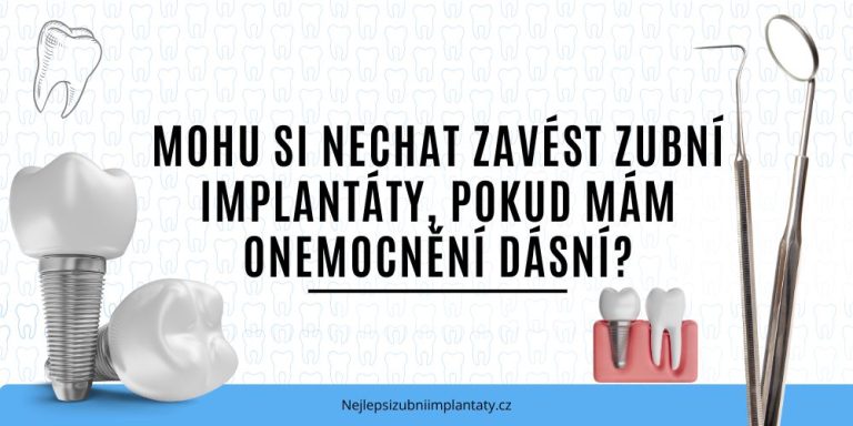 Mohu si nechat zavést zubní implantáty, pokud mám onemocnění dásní