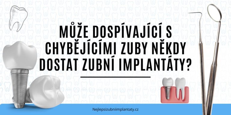 Může dospívající s chybějícími zuby někdy dostat zubní implantáty