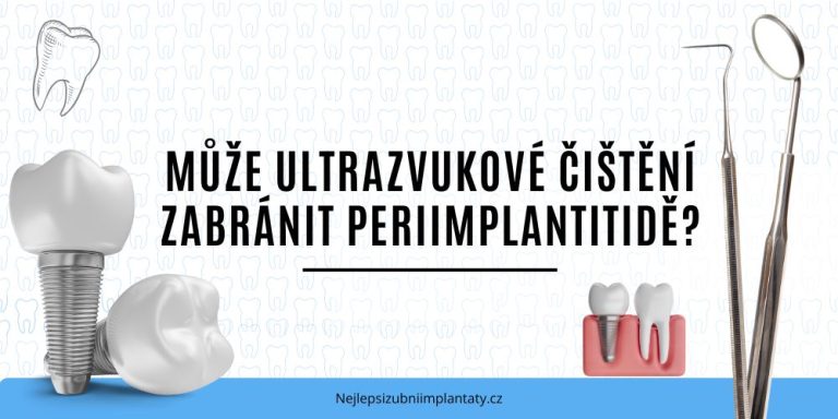 Může ultrazvukové čištění zabránit periimplantitidě