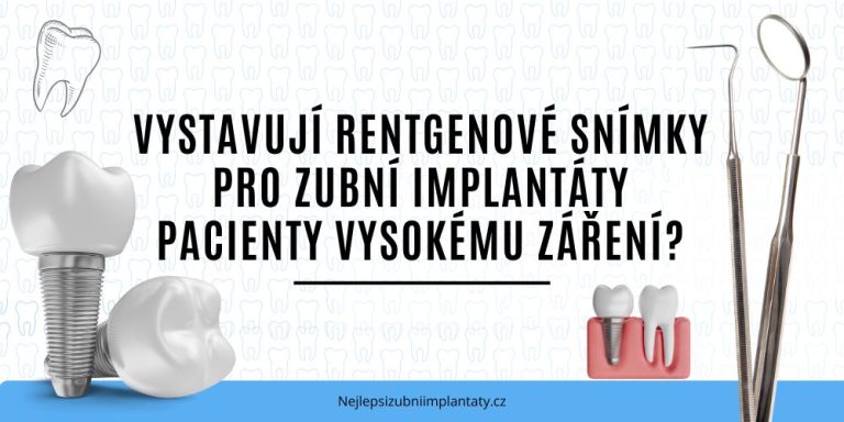 Vystavují rentgenové snímky pro zubní implantáty pacienty vysokému záření