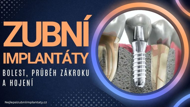 Zubní implantáty – bolest, průběh zákroku a hojení