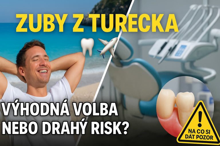 Zubní implantáty z Turecko, dobrý nebo špatný nápad?