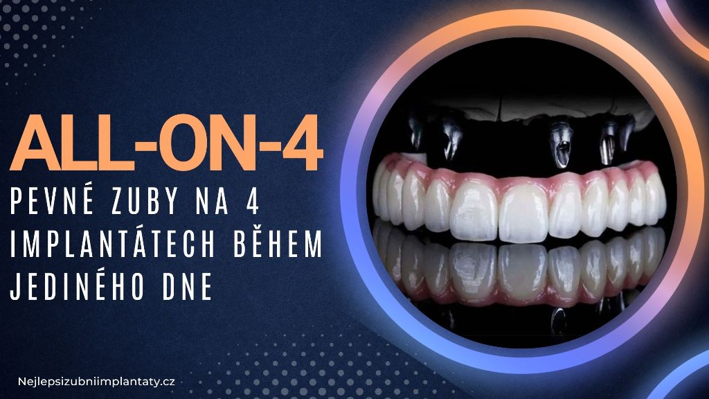 All-on-4_ Pevné zuby na 4 implantátech během jediného dne