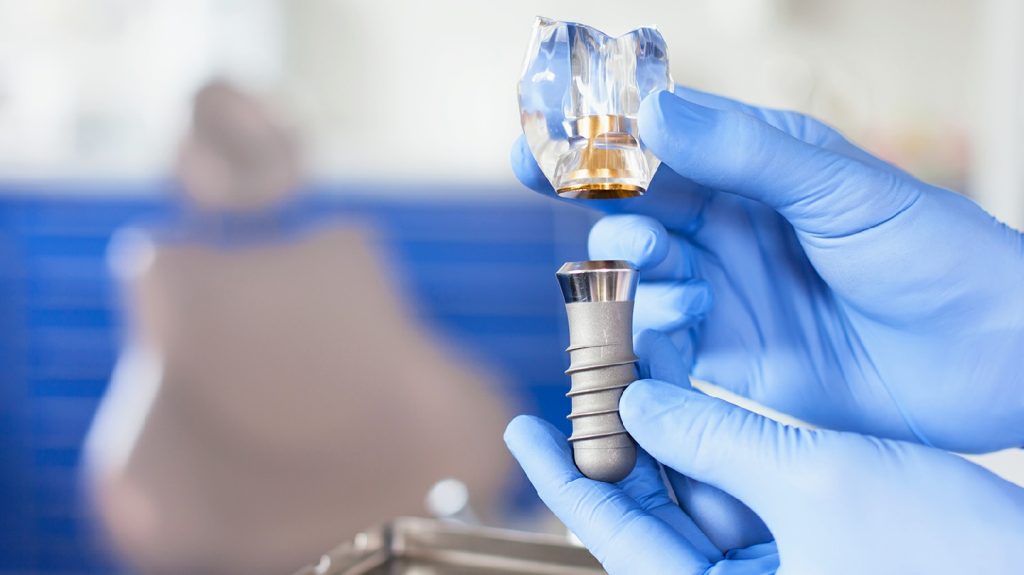 Zubní implantáty Praha