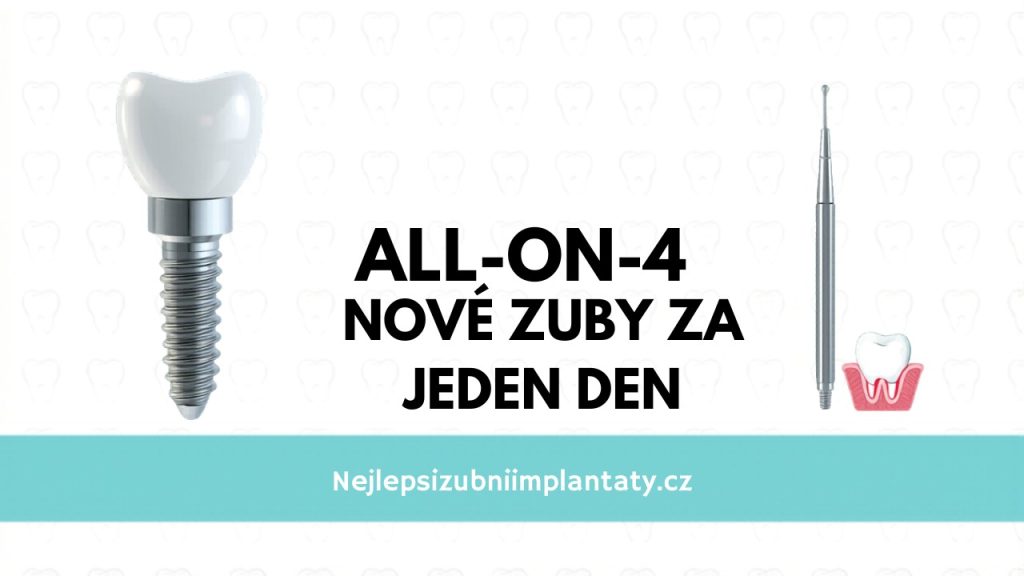 All on 4 nove zuby cena
