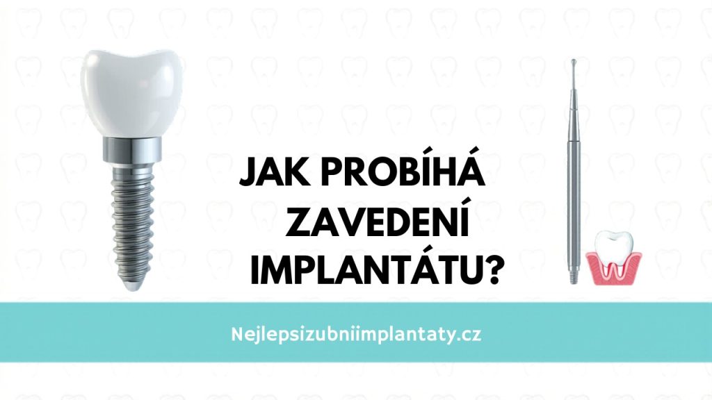 Jak probiha zavedeni implantatu
