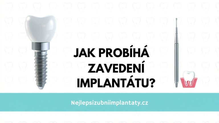 Jak probiha zavedeni implantatu